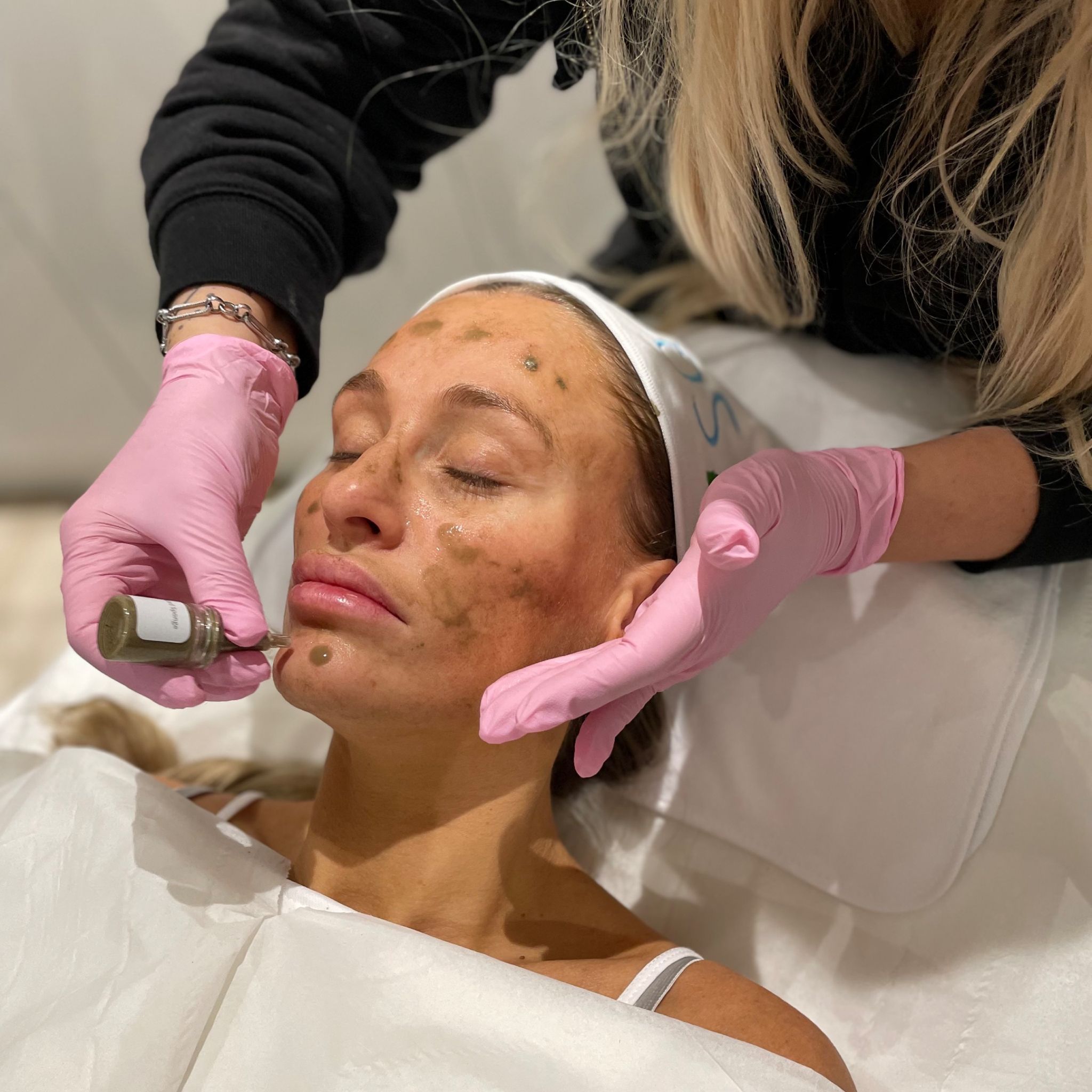 sqt bio microneedling treatment training